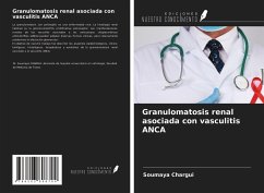 Granulomatosis renal asociada con vasculitis ANCA - Chargui, Soumaya
