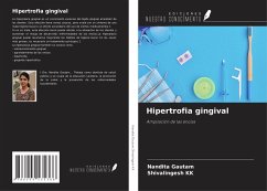 Hipertrofia gingival - Gautam, Nandita; Kk, Shivalingesh