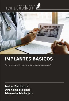 IMPLANTES BÁSICOS - Pathania, Neha; Nagpal, Archana; Mahajan, Mamata