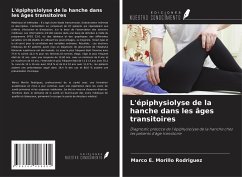 L'épiphysiolyse de la hanche dans les âges transitoires - Morillo Rodriguez, Marco E.