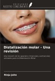 Distalización molar - Una revisión