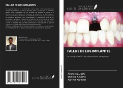 FALLOS DE LOS IMPLANTES - Joshi, Akshay D.; Kolhe, Shweta A.; Agrawal, Agrima