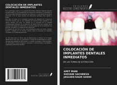 COLOCACIÓN DE IMPLANTES DENTALES INMEDIATOS - Mani, Amit; Sachdeva, Shivani; Sodhi, Jasleen Kaur