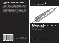 Colocación de stent en la arteria renal - Hammemia, Mhamad