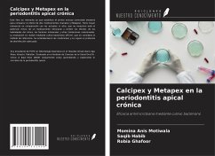 Calcipex y Metapex en la periodontitis apical crónica - Motiwala, Momina Anis; Habib, Saqib; Ghafoor, Robia