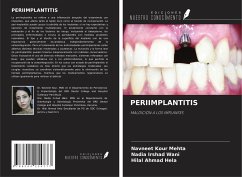 PERIIMPLANTITIS - Kour Mehta, Navneet; Irshad Wani, Nadia; Ahmad Hela, Hilal