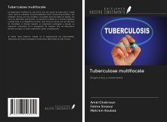 Tuberculose multifocale - Chakroun, Amal; Smaoui, Fatma; Koubaa, Makram