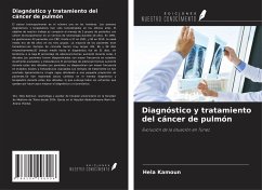 Diagnóstico y tratamiento del cáncer de pulmón - Kamoun, Hela