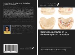 Retenciones directas en la dentadura parcial removible - Pawar (Suryawanshi), Priyadarshani