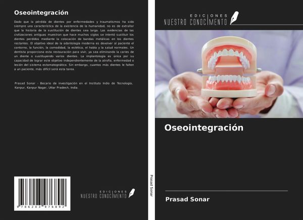 Oseointegración Oseointegración