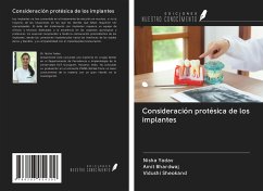 Consideración protésica de los implantes - Yadav, Nisha; Bhardwaj, Amit; Sheokand, Vidushi