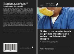 El efecto de la osteotomía del primer metatarsiano en las condiciones del antepié - Kellermann, Peter