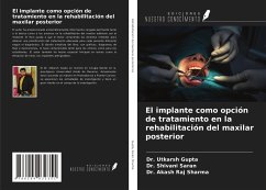 El implante como opción de tratamiento en la rehabilitación del maxilar posterior - Gupta, Utkarsh; Saran, Shivani; Sharma, Akash Raj