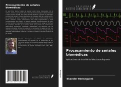 Procesamiento de señales biomédicas - Bensegueni, Skander
