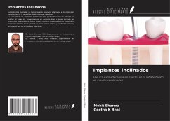 Implantes inclinados - Sharma, Mohit; Bhat, Geetha K