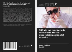 SBS de los brackets de ortodoncia tras la desproteinización del esmalte - Fathima, Ferin; S, Ravi