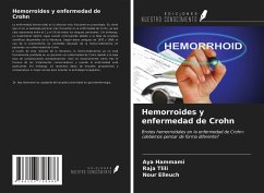 Hemorroides y enfermedad de Crohn - Hammami, Aya; Tlili, Raja; Elleuch, Nour