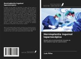 Hernioplastia inguinal laparoscópica