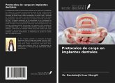 Protocolos de carga en implantes dentales