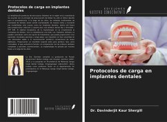 Protocolos de carga en implantes dentales - Shergill, Davinderjit Kaur