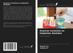 Avances recientes en implantes dentales - K. S., Rajesh; M, Gokulan