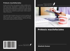 Prótesis maxilofaciales - Kumar, Shailesh