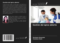 Cover Gestión del ápice abierto