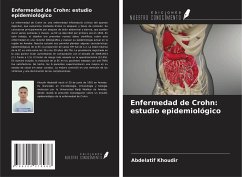 Enfermedad de Crohn: estudio epidemiológico - Khoudir, Abdelatif