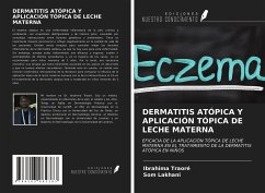 DERMATITIS ATÓPICA Y APLICACIÓN TÓPICA DE LECHE MATERNA - Traoré, Ibrahima; Lakhani, Som