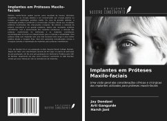 Implantes em Próteses Maxilo-faciais - Dondani, Jay; Gangurde, Arti; Jani, Harsh