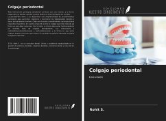 Colgajo periodontal - S., Rohit