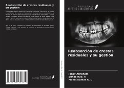 Reabsorción de crestas residuales y su gestión - Abraham, Joncy; Rao. K, Suhas; Kumar A. D, Manoj