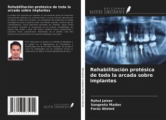 Rehabilitación protésica de toda la arcada sobre implantes - Jainer, Rahul; Madan, Sangeeta; Ahmed, Faraz