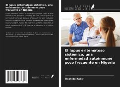 El lupus eritematoso sistémico, una enfermedad autoinmune poco frecuente en Nigeria - Kabir, Rashida