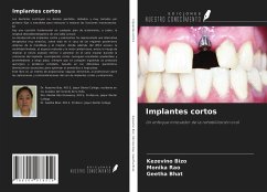 Implantes cortos - Bizo, Kezevino; Rao, Monika; Bhat, Geetha