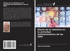 Efecto de la luteolina en la actividad antimetastásica de los GBM - El Gueder, Dorra