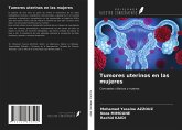 Tumores uterinos en las mujeres