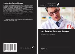 Implantes instantáneos - S., Rohit