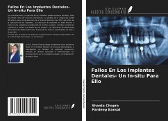 Fallos En Los Implantes Dentales- Un In-situ Para Ello - Chopra, Shanta; Bansal, Pardeep