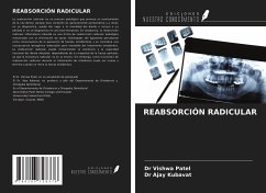 REABSORCIÓN RADICULAR - Patel, Vishwa; Kubavat, Ajay