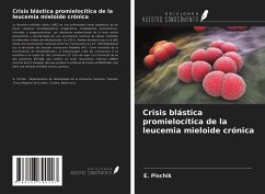 Crisis blástica promielocítica de la leucemia mieloide crónica - Pischik, E.