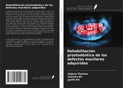 Rehabilitación prostodóntica de los defectos maxilares adquiridos - Thomas, Anjana; Kp, Cherian; Ks, Jyothi