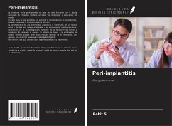 Cover Peri-implantitis