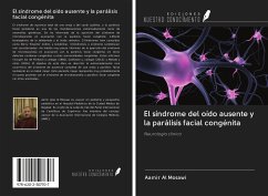 El síndrome del oído ausente y la parálisis facial congénita - Al Mosawi, Aamir