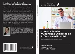 Stents y Férulas Quirúrgicas Utilizadas en Prótesis Maxilofacial - Thakur, Anuja; Gupta, Rajeev; Kapoor, Himanshu