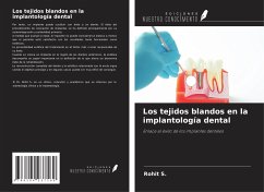 Los tejidos blandos en la implantología dental - S., Rohit