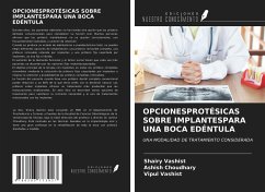 OPCIONESPROTÉSICAS SOBRE IMPLANTESPARA UNA BOCA EDÉNTULA - Vashist, Shairy; Choudhary, Ashish; Vashist, Vipul