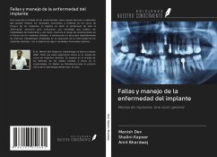 Fallas y manejo de la enfermedad del implante - Dev, Manish; Kapoor, Shalini; Bhardwaj, Amit