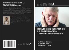 DESVIACIÓN INTERNA DE LA ARTICULACIÓN TEMPOROMANDIBULAR - Ganesh, Mithun; Lall, Amit B.; Tomar, Sanjeev