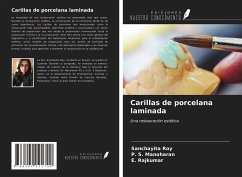 Carillas de porcelana laminada - Roy, Sanchayita; Manoharan, P. S.; Rajkumar, E.